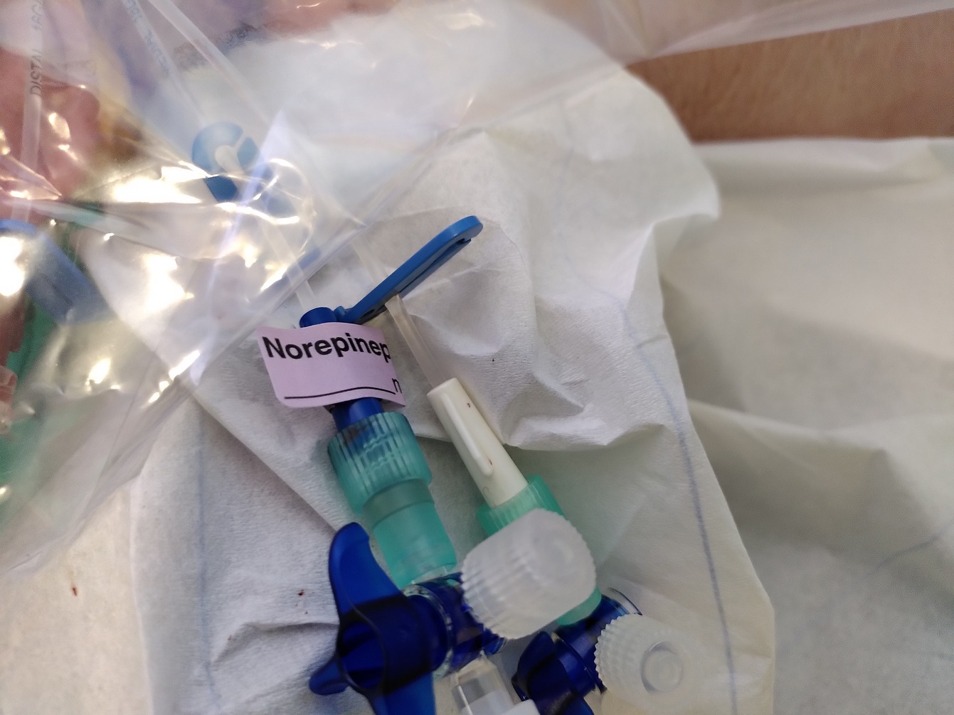 Noradrenalin-Schenkel